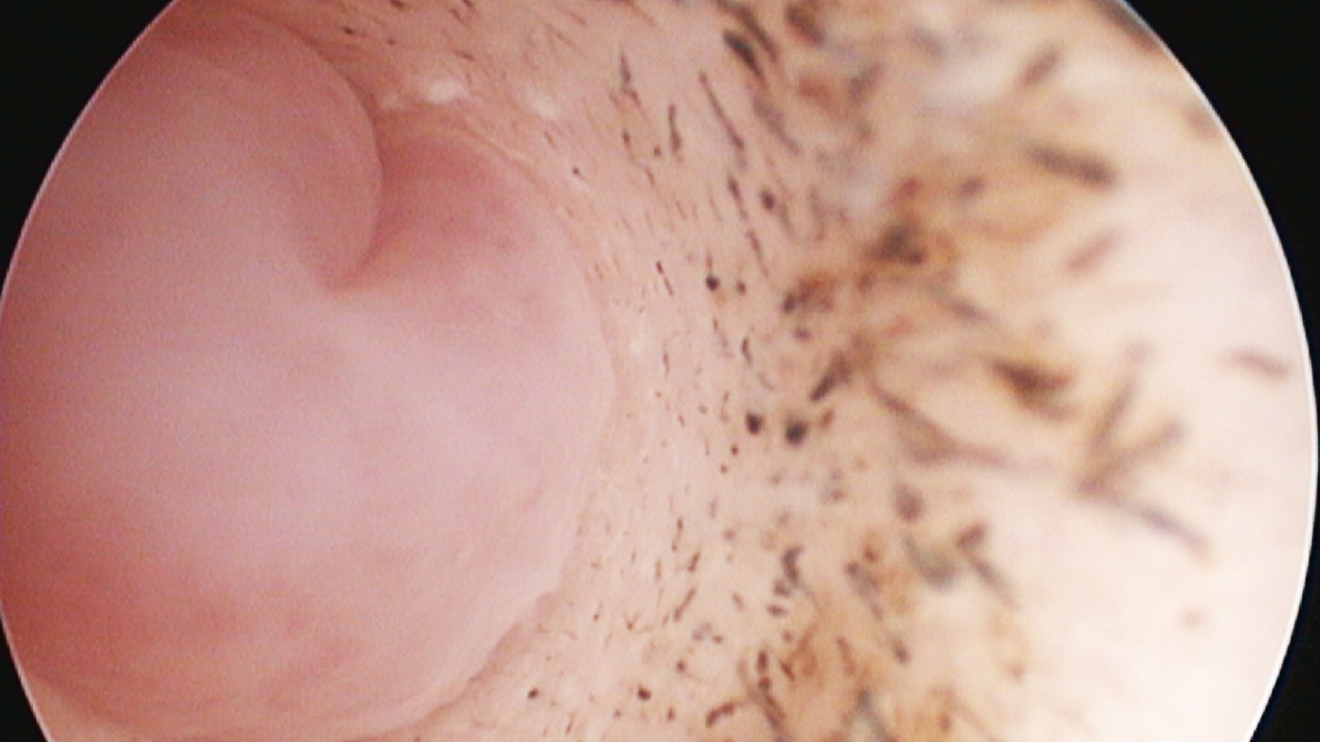 MITTELOHR VJ 11 2021